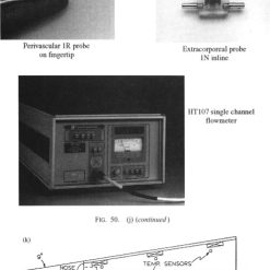 MTG-FB-R5-500 | 5 TEMPERATURE MAGNETOSTRICTIVE FLEX PROBE W/ SPRING ASSEMBLY AND EXPANSION AT THE HEAD OF PROBE FOR LOW WATER DETECTION. OVERALL LENGTH 500" Tanks 4,8,9)
